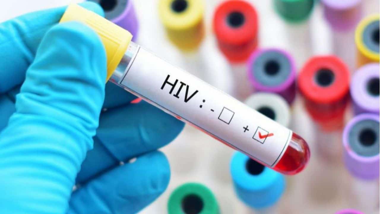 Acordare spor HIV/SIDA – TBC